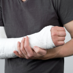Fracture et lésions ligamentaires