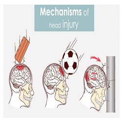 Blessure à la Tête