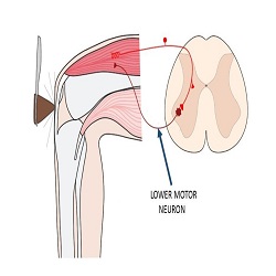 Motoneurones inférieurs