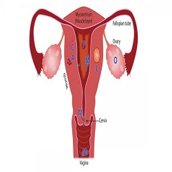 Troubles Menstruels