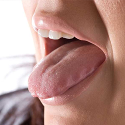Bouche Seche Traitement